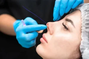 جراحی بینی با پیزوسرجری در آمل جراحی بینی با پیزوسرجری در آمل