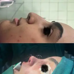 دکتر مریم جهاندار -جراح زیبایی بینی در مازندران دکتر مریم جهاندار -جراح زیبایی بینی در مازندران