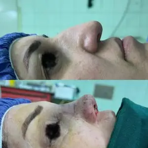 دکتر مریم جهاندار -جراح زیبایی بینی در مازندران دکتر مریم جهاندار -جراح زیبایی بینی در مازندران