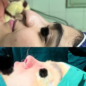 دکتر مریم جهاندار -جراح زیبایی بینی در مازندران دکتر مریم جهاندار -جراح زیبایی بینی در مازندران