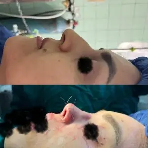 دکتر مریم جهاندار -جراح زیبایی بینی در مازندران دکتر مریم جهاندار -جراح زیبایی بینی در مازندران