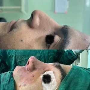 دکتر مریم جهاندار -جراح زیبایی بینی در مازندران دکتر مریم جهاندار -جراح زیبایی بینی در مازندران