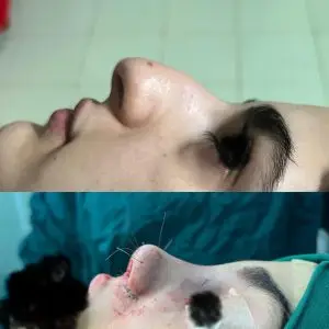 دکتر مریم جهاندار -جراح زیبایی بینی در مازندران دکتر مریم جهاندار -جراح زیبایی بینی در مازندران