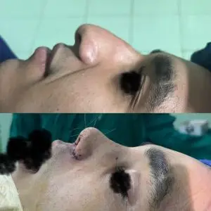 دکتر مریم جهاندار -جراح زیبایی بینی در مازندران هزینه عمل بینی در شمال