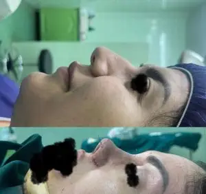 دکتر مریم جهاندار -جراح زیبایی بینی در مازندران دکتر مریم جهاندار -جراح زیبایی بینی در مازندران