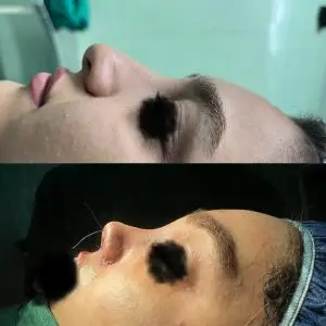 دکتر مریم جهاندار -جراح زیبایی بینی در مازندران دکتر مریم جهاندار -جراح زیبایی بینی در مازندران