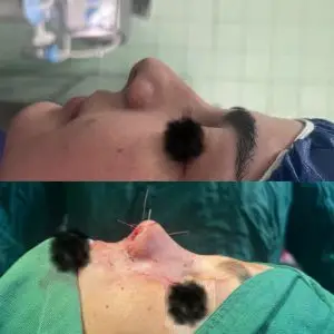 دکتر مریم جهاندار -جراح زیبایی بینی در مازندران دکتر مریم جهاندار -جراح زیبایی بینی در مازندران