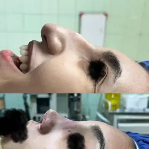 دکتر مریم جهاندار -جراح زیبایی بینی در مازندران دکتر مریم جهاندار -جراح زیبایی بینی در مازندران