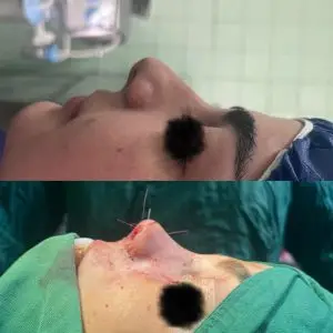 دکتر مریم جهاندار -جراح زیبایی بینی در مازندران دکتر مریم جهاندار -جراح زیبایی بینی در مازندران